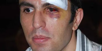 Emma Waroka: Alex Tiba-Tiba Ga Bisa Bahasa Indonesia