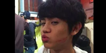 Siapa Yang Mencium Yoseob?