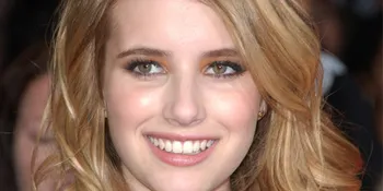 Magic di Balik Gingsul Emma Roberts