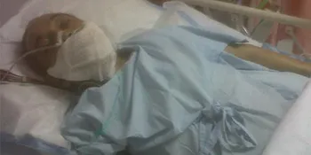 Franky Sahilatua Derita Kanker Sumsum Tulang Belakang