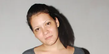 Melanie Subono Tak Tahu Penyebab Tumornya