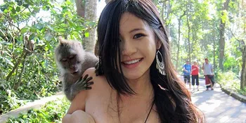 'The Monkey Girl' Sebar Foto Implan Payudara