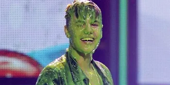 Gara-Gara Slime, Justin Bieber Cukur Habis Rambutnya?