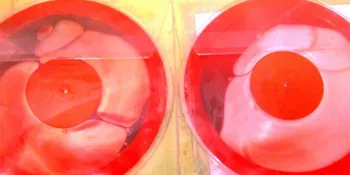 Flaming Lips Rilis Vinyl Berdarah