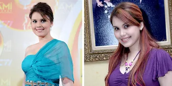 Infeksi Usus, Cindy Claudia Harahap Jalani Operasi