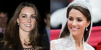 Amerika Lecehkan Inggris Dengan Gigi Busuk Kate Middleton