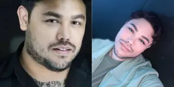 10 Transformasi Artis Sebelum dan Sesudah Filler Bibir, Ada yang Ketagihan Berkali-Kali