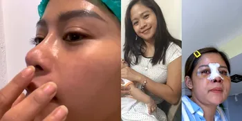 3 Kali Oplas, 11 Potret Transformasi Farida Nurhan yang Kini Kinclong - Sempat Dihujat dan Disebut Mirip Michael Jackson