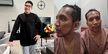 7 Potret Desta Jalani Transplantasi Rambut dan Jenggot Jambang, Mulai Terlihat Tipis-Tipis Brewoknya