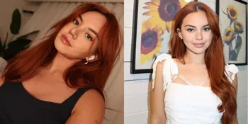 7 Potret Terbaru Shafa Harris Setelah Oplas di Korea, Bikin Pangling Makin Cantik - Disebut Wajah Judesnya Hilang