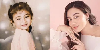 7 Potret Transformasi Margin Wieheerm, Hidung dan Bibir Asli Cantik dari Kecil - Banyak yang Ngira Dewi Perssik Saking Miripnya