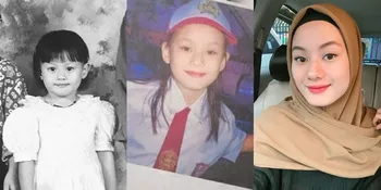 Lepas Masa Lajang, Ini 9 Potret Transformasi Dinda Hauw yang Pernah Botak Demi Peran di Film