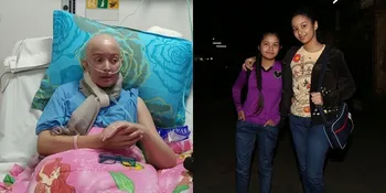Ada Donatur, Anak Yana Zein Akan Segera Sekolah Lagi