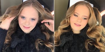 Alami Down Syndrome, Remaja Cantik Ini Jadi Model Hingga Dikontrak 5 Agensi