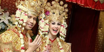 Menikah Muda, Arumi Bachsin Tak Kejar Momongan