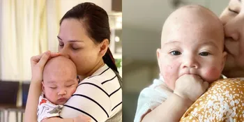 Bayi Mona Ratuliu Idap Dermatitis Atopik, Kulit Dipenuhi Bintik Warna Merah Hingga Bagian Wajah