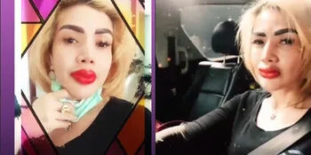 Bibir Bengkak Parah Usai Sulam Warna, Penampilan Barbie Kumalasari Jadi Begini