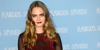 Cantik Berbunga-Bunga, Cara Delevingne Ekspos Kaki Jenjangnya