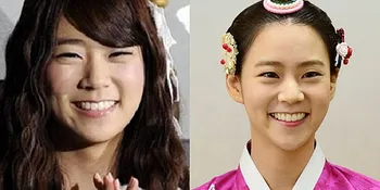 Dagu Lebih Lancip, Seung Yeon KARA Lakukan Operasi Plastik?