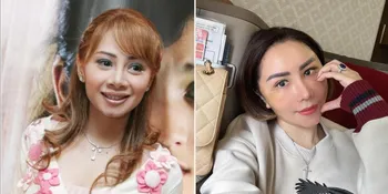 Dari Face Lift hingga Sedot Lemak, Ini Alasan Femmy Permatasari Terus Lakukan Operasi Plastik