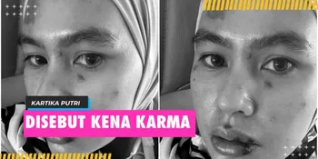 Disebut Kena Karma, Kartika Putri Beri Klarifikasi Soal Penyakitnya