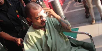 Dokter Belum Sarankan Vokalis Saint Loco Jalani Operasi Plastik