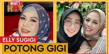 Elly Sugigi Potong Gigi, Penampilannya Bikin Pangling