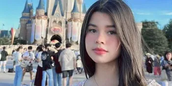 Fakta Menarik Maria Theodore, Artis Cantik Blasteran Bule yang Ternyata Punya Skoliosis