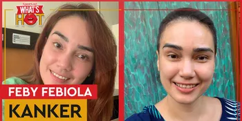 Feby Febiola Gunduli Rambut, Jelaskan Penyebab Di Balik Sakitnya