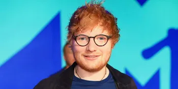 [FOTO] Alami Kecelakaan, Tulang Tangan Ed Sheeran Patah