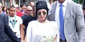 [FOTO] Punggung Memar Karena Dibekam, Lady Gaga Masuk Angin?