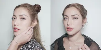 Foto Terbaru Jessica Iskandar Usai Putus dari Richard Kyle Jadi Sorotan, Wajah Terlihat Pucat dan Leher Membengkak