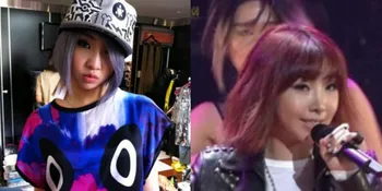 [Foto] Wajah 'Berubah', Minzy 2NE1 Operasi Plastik?