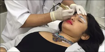 Habis Sulam Alis, Bianca Liza Lebih Percaya Diri