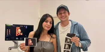 Hamil 6 Bulan, Vio Cerita Ngidam dan Perhatian Andrew Andika
