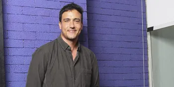 Hamish Daud Tunjukkan Foto X-Ray Tengkorak Kepalanya Penuh Baut, Netizen: Gini Aja Ganteng!