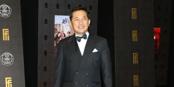Hanung Bramantyo Alami Syaraf Kejepit Selama Empat Tahun, Terungkap Gejala Awal dan Penyebabnya