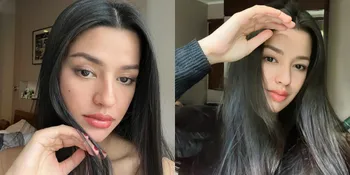 Jadi Solusi Sembuhkan Penyakit yang Dideritanya, Ini 7 Potret Susan Sameh yang Disarankan Dokter untuk Hamil