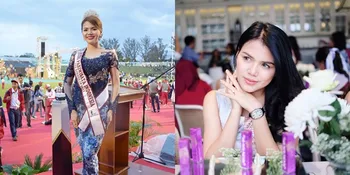 Kalia Labitta, Dokter Gigi Cantik Adik Vicky Shu Yang Pernah Ikut Puteri Indonesia