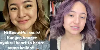 Kembali Dapat Bullying Tentang Wajahnya, Marshanda Ungkit Dampak Buruk Cyberbullying Bagi Kesehatan Mental