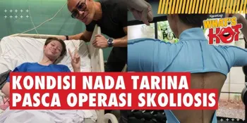 Kondisi Nada Tarina Pasca Operasi Skoliosis, Bekas Jahitan Besar - Timbul Nyeri Dan Pemulihan Emosi
