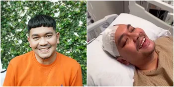 Kondisi Semakin Membaik, Kepala Indra Bekti Dipasang Selang Untuk Membuang Cairan Ini