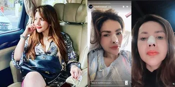 Korbankan Tulang Telinganya, 8 Potret Terbaru Barbie Kumalasari Usai Jalani Operasi Hidung: Bisa Jebol!
