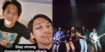 Kronologi Rian Personel D'Masiv Alami Kecelakaan Tunggal, Daging Sampai Robek!