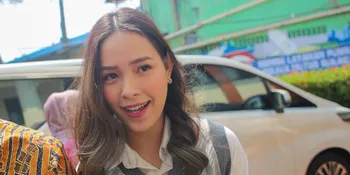 Lady Nayoan Baru Saja Alami Kecelakaan, Dokter Richard Lee Ungkap Kondisi Terkininya