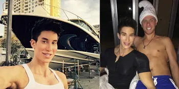 Lebam dan Pucat, Justin Jedlica Tetap Merasa Dirinya Ganteng