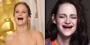 Lucu! Seleb-Seleb Cantik Ini Ompong Giginya