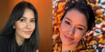 Males Treatment Laser, Ini 7 Potret Titi Radjo Padmaja yang Cantik Alami - Pamer Freckles di Wajah