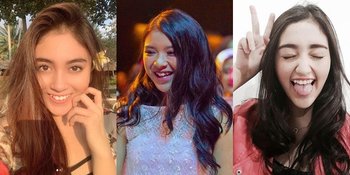 Manisnya Kelewatan, 8 Seleb Bergigi Gingsul Ini Senyumnya Bikin Meleleh