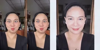 Masih Bengkak Dikit, Ini 7 Potret Terbaru Dian Nitami Pasca 3 Minggu Oplas